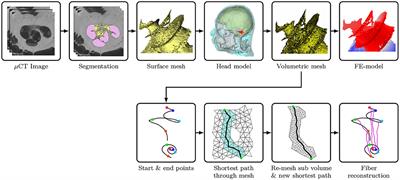 Electrical Stimulation in the Human Cochlea: A Computational Study Based on High-Resolution Micro-CT Scans